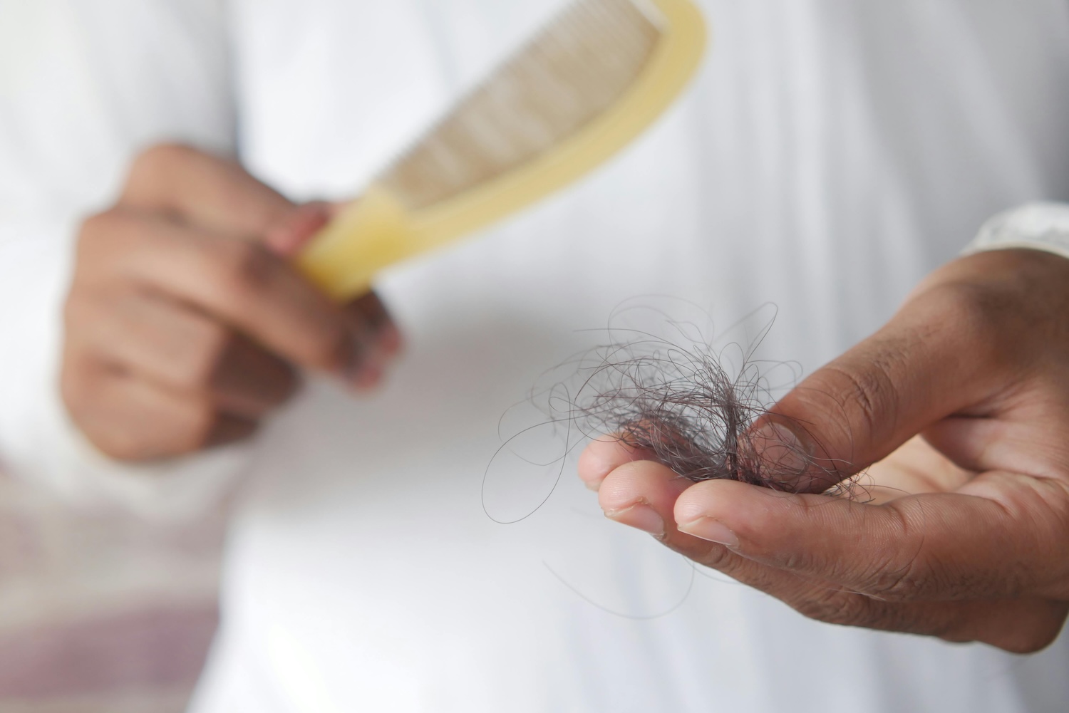 Featured image for “Addressing Hair Loss Awareness”